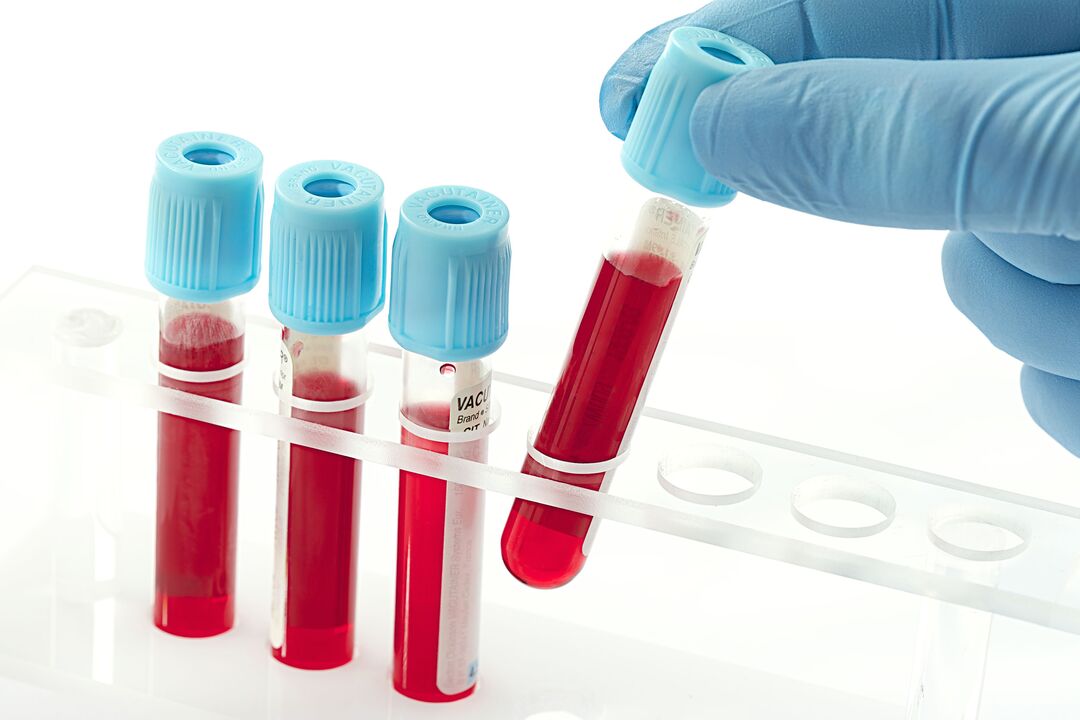 मानव पेपिलोमावायरस का निदान करने के लिए रक्त परीक्षण