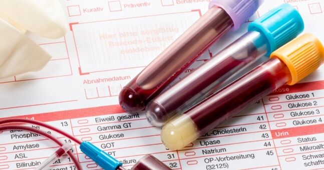 मानव पेपिलोमावायरस के लिए रक्त परीक्षण